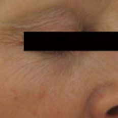 Collagenizer Skin Care